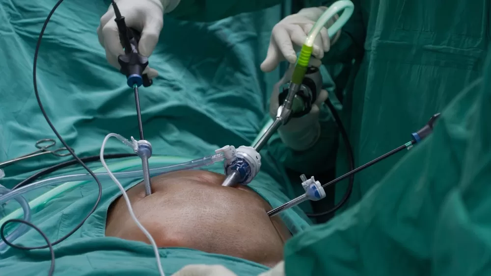 Equipo quir&uacute;rgico durante reparaci&oacute;n de hernia