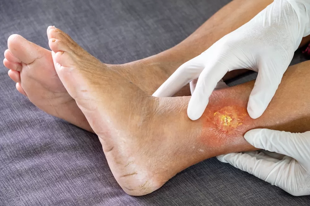 Manejo de heridas quir&uacute;rgicas